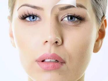 Hyaluronic Acid Injectable