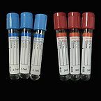 Vacuum blood collection tube