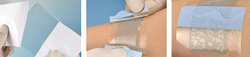 Medical Hydrogel Dressing