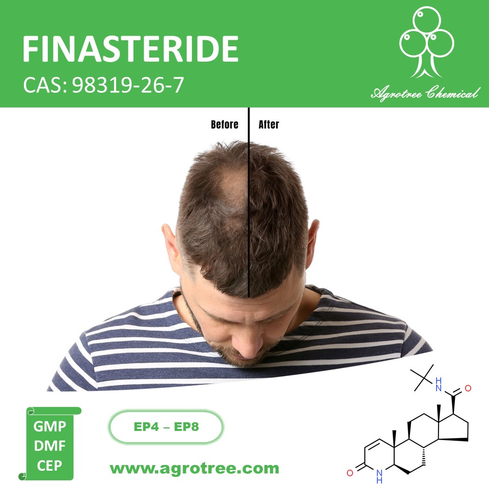 FINASTERIDE