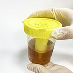 40ml Vacuum Urine Container Urine Measurement Container