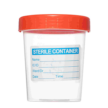 Urine Cup 120ml Urine Specimen Container Urine Cup 120 Ml With Label