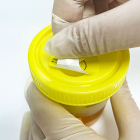 60ml Vacuum Urine Container Urine Measurement Container