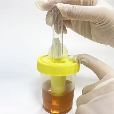 30ml Vacuum Urine Container Urine Measurement Container
