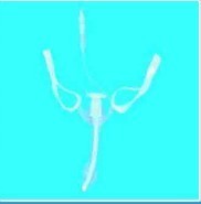 Disposable Tracheal Carving Catheter