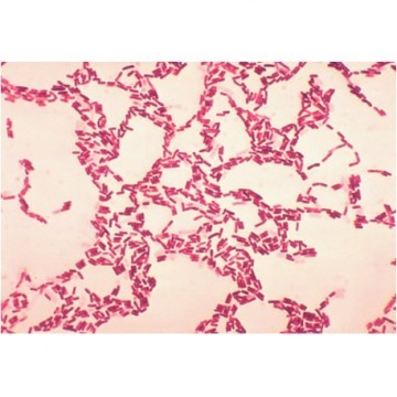 Bacillus coagulans (Strain Number: B. Coagulans 123)