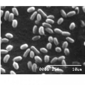 Streptococcus thermophilus