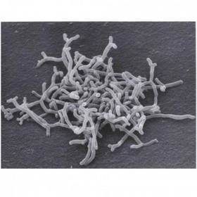 Bifidobacterium longum