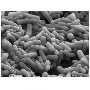 Bifidobacterium animalis (B.lactis)