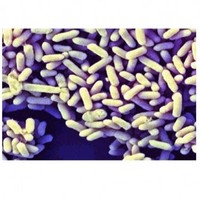 Bifidobacterium infantis