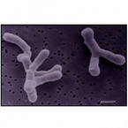 Bifidobacterium adolescentis