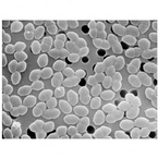 Enterococcus faecium