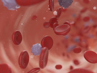 A new draft recommendation relating to anticoagulation for discharged patients with COVID-19 has been issued by the American Society of Hematology (ASH).