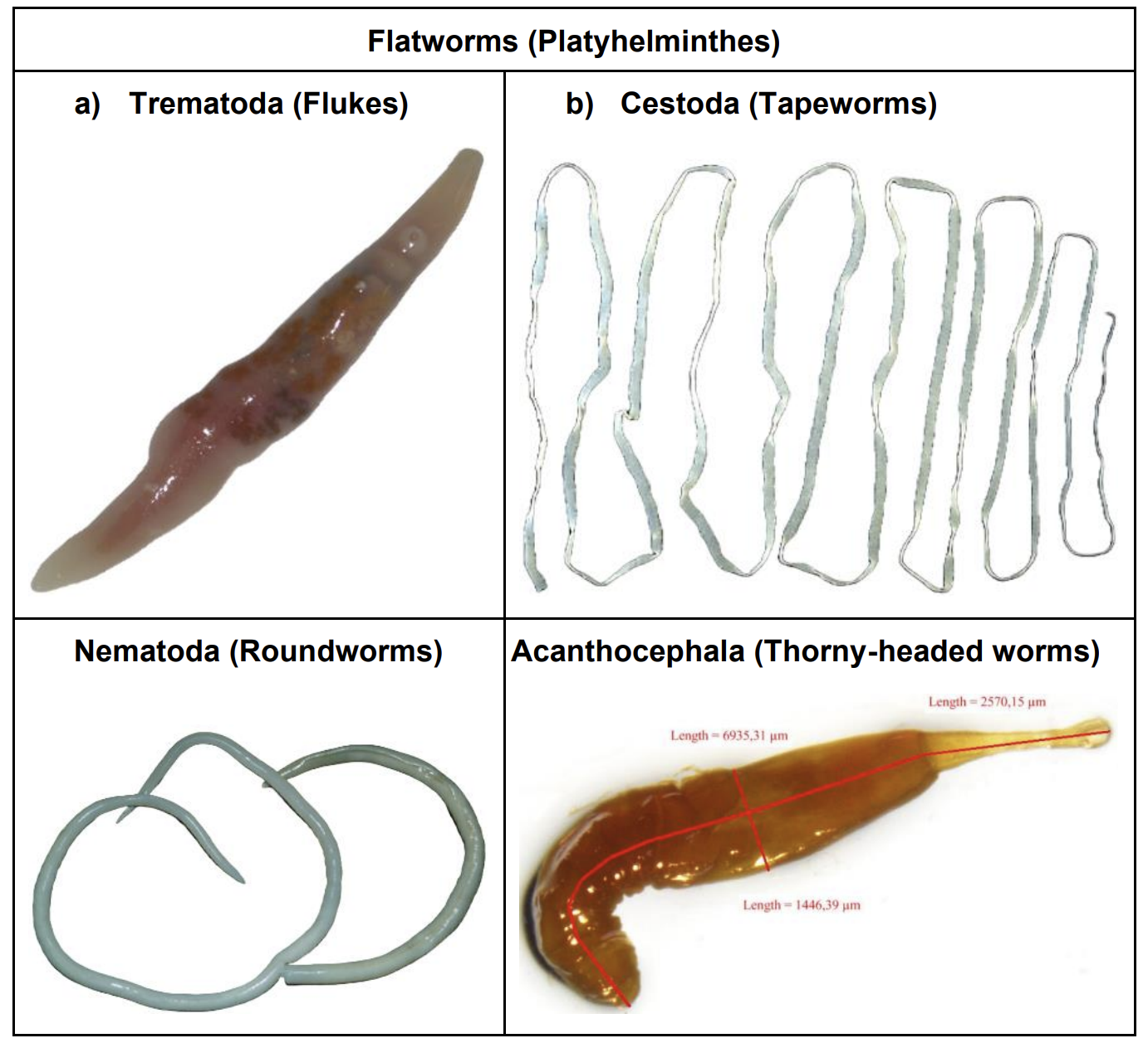 Flatworms（Platyhelminthes）