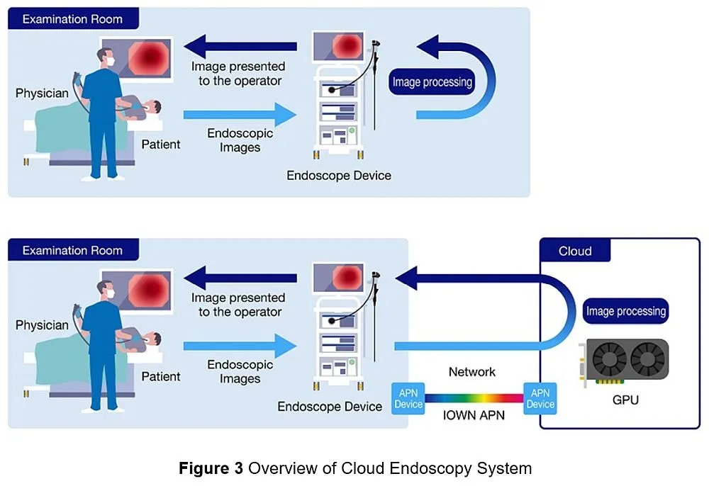 Overview of Cloud Endoscopy System