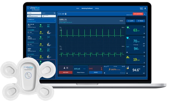 UbiqVue™ 2A Multiparameter System.jpg