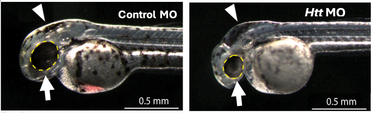 Figure 2a & b: Rescue of morphological abnormalities induced byhttknockdown